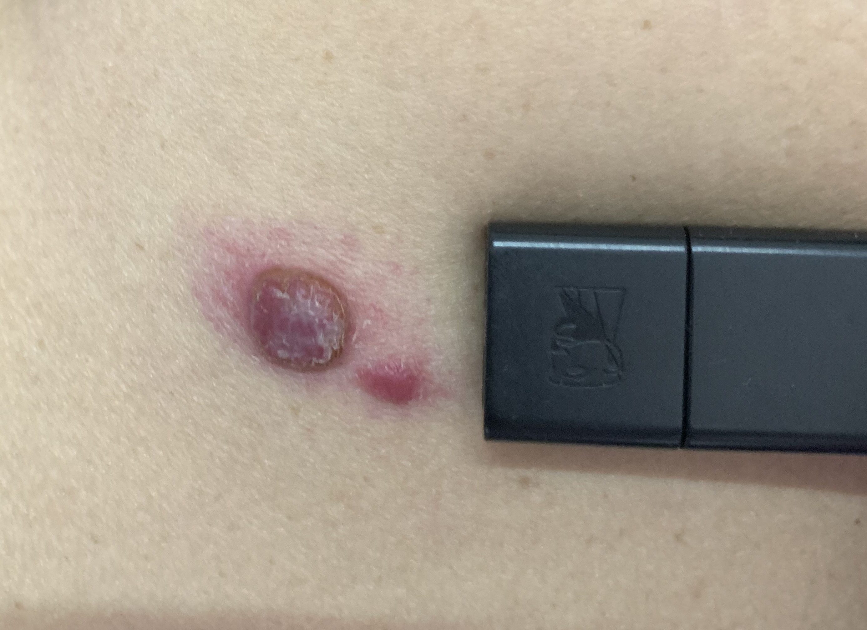 病例分享20210607